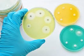 Antibiogramme par diffusion