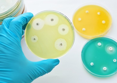 Antimicrobial Susceptibility Testing