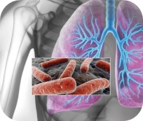 Analyse mycobactéries non-tuberculeuses